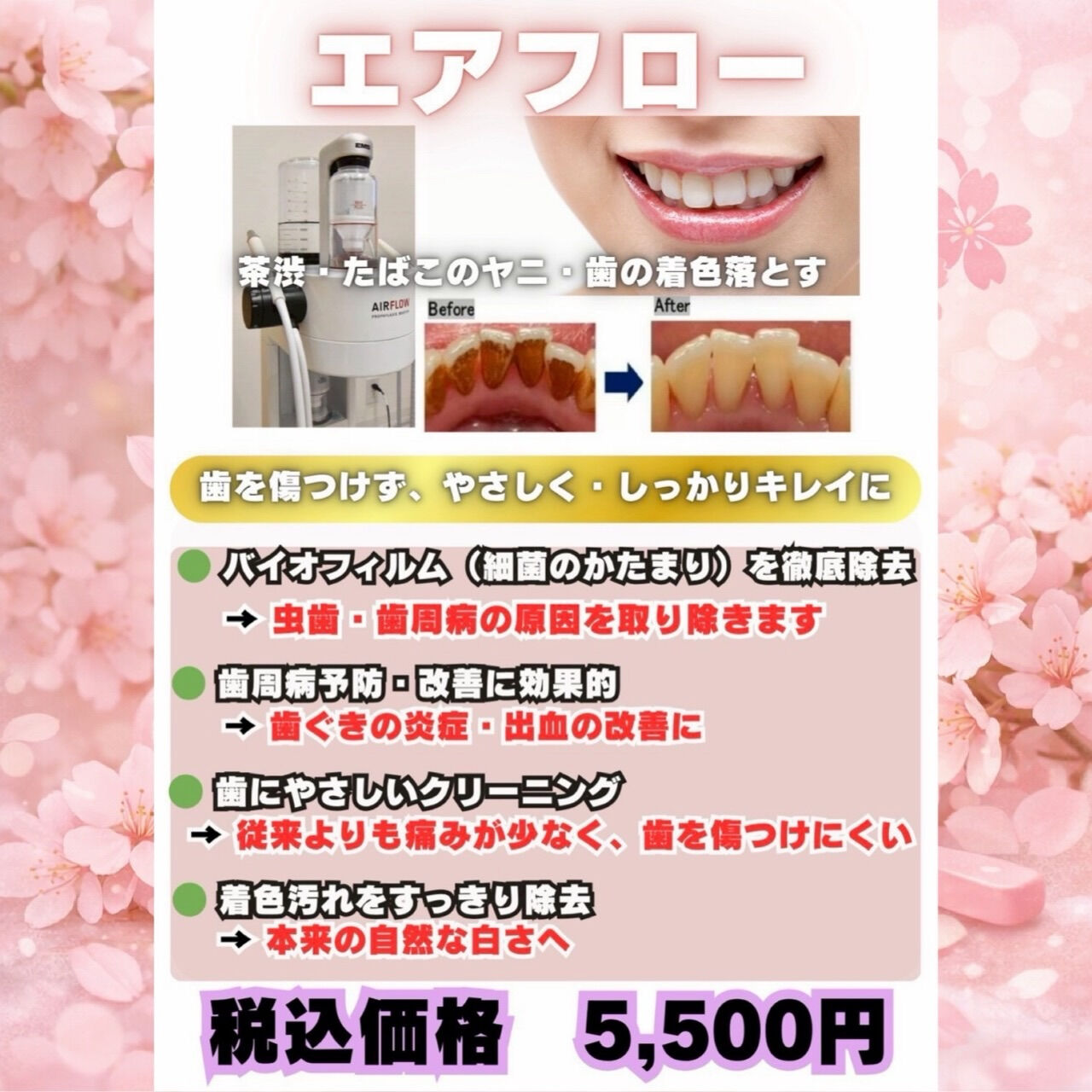 「新生活、口元からアップデート