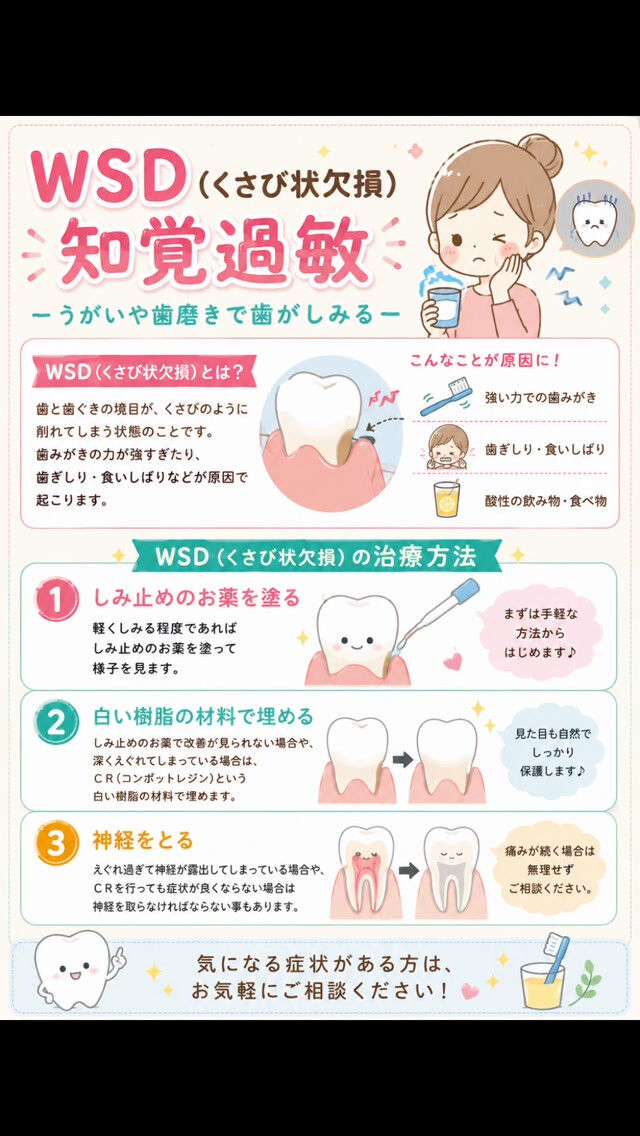 🌿歯がしみる…それ、WSD（くさび状欠損）かもしれません！🦷